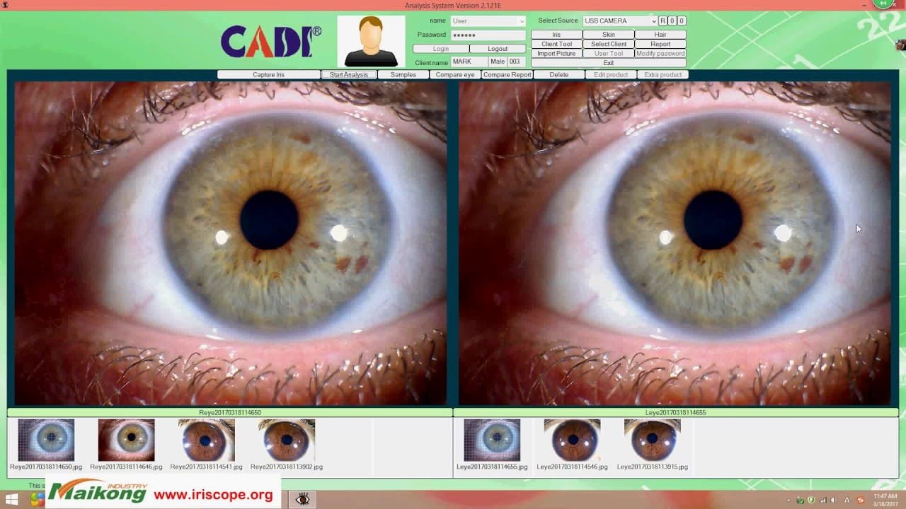 iridology camera,best iridology camera,iriscope iridology camera,professional iridology camera,iridology camera for iphone,iridology camera stand,iridology camera for sale,iridology camera australia,iridology camera app,iridology cameras,iridology camera and software,eye camera iridology,is iridology legitimate,what is iridology,is iridology reliable,how to take a picture of your eye for iridology,how to take iridology photos,what is iris camera,iridology camera in india,iridology pictures and meanings,what can iridology detect,how much does iridology cost,iris camera iridology,does iridology work,what is iridology used for,best iridology digital camera,can iridology detect pregnancy,is iridology real,videology cameras,videology camera drivers,videology industrial-grade cameras,iridology camera 12mp,iris eye photography near me,what is camera iris,iridologist camera,