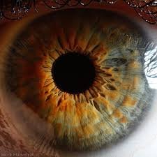 iridology examples